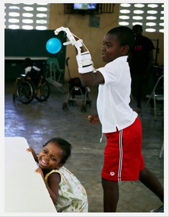 ３Ｄプリンターで「手」を作製！ハイチの指のない少年、キャッチボールを楽しむ